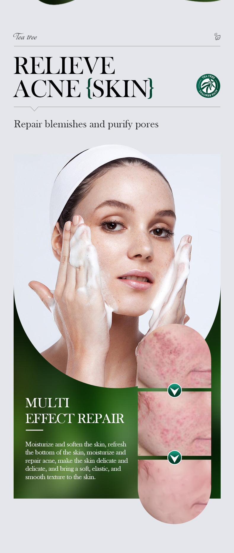 Tea Tree Oil Control Bubble Gentle Cleansing Milk