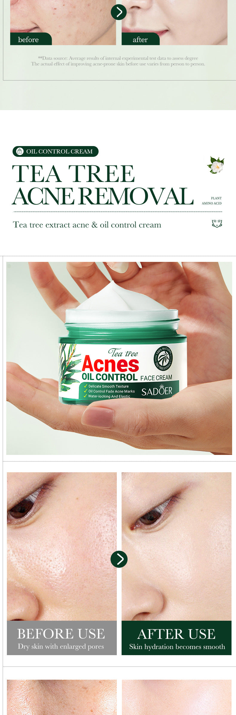 Tea Tree Acne Treatment & Oil Control Face Cream